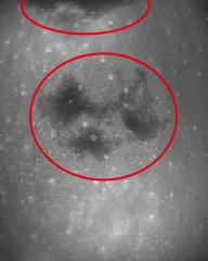 SWIR 1550 nm: two dark bruises with clear borders (marked by the tester).