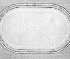 Shadowless light (LS-LFX100): surface frosting hides the weld detail.